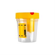 URINTRANSFER 120ML SFUSI T/GIALLO